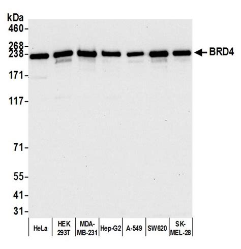 brd4 antibody bethyl|BRD4 Polyclonal Antibody (A301.